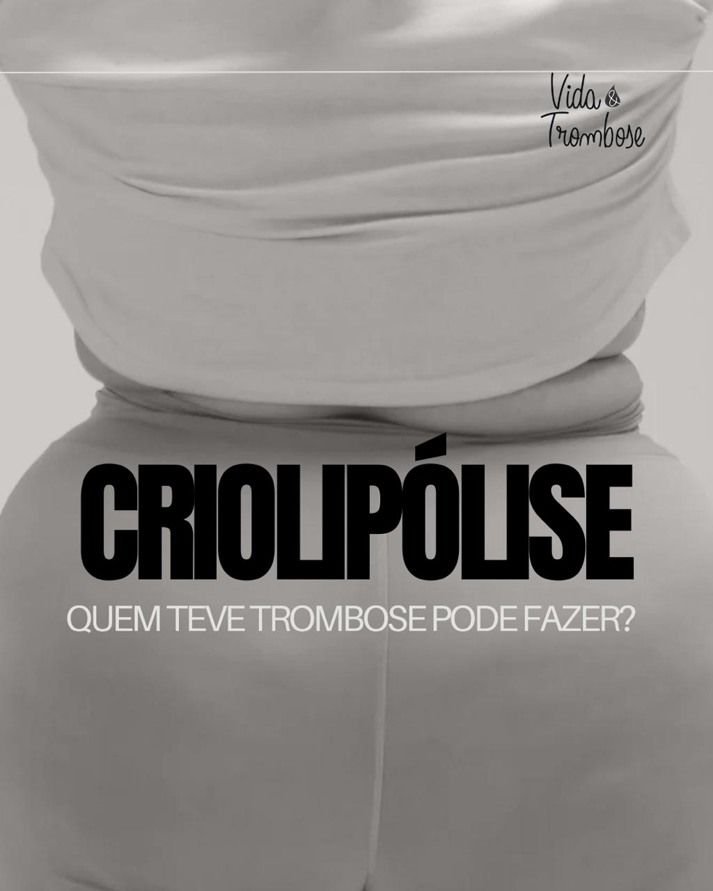 Quem teve trombose pode fazer criolipólise?